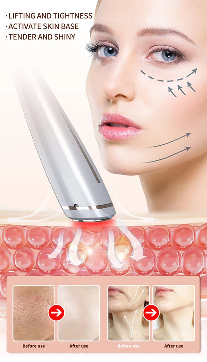 Lifting RF device for Facial and Eyes